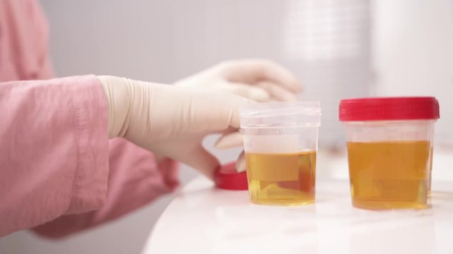 Synthetic Urine